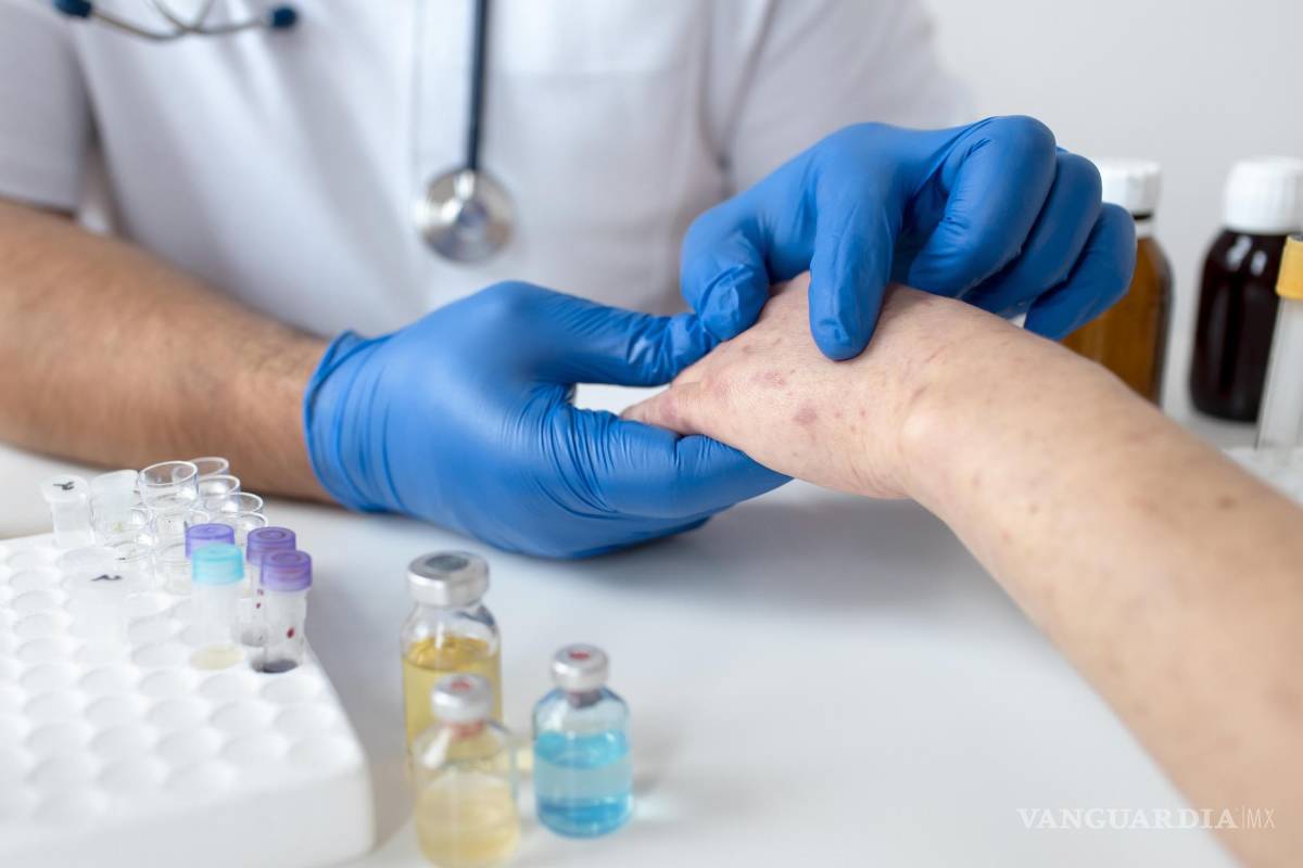 $!Al cabo de uno o dos días por lo general aparece una erupción cutánea que suele empezar en forma de manchas rojas planas.