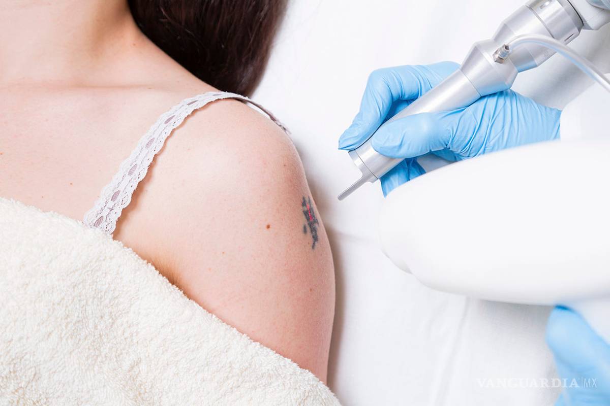 Aumenta número de consultas por problemas con tatuajes