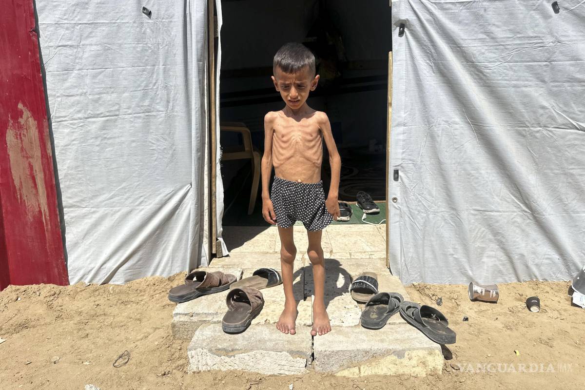 $!El niño gazatí Osama al Raqab, de 5 años, quiere jugar al fútbol o montar en bicicleta, pero la falta de energía no se lo permite.