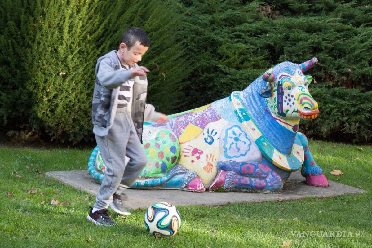 Trasplantan casi por completo piel de un niño enfermo