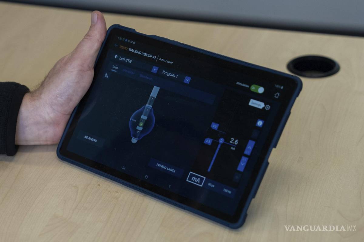 $!El psiquiatra Dr. Martijn Figee muestra una tableta utilizada para programar la cantidad de estimulación eléctrica cerebral profunda administrada a los pacientes.