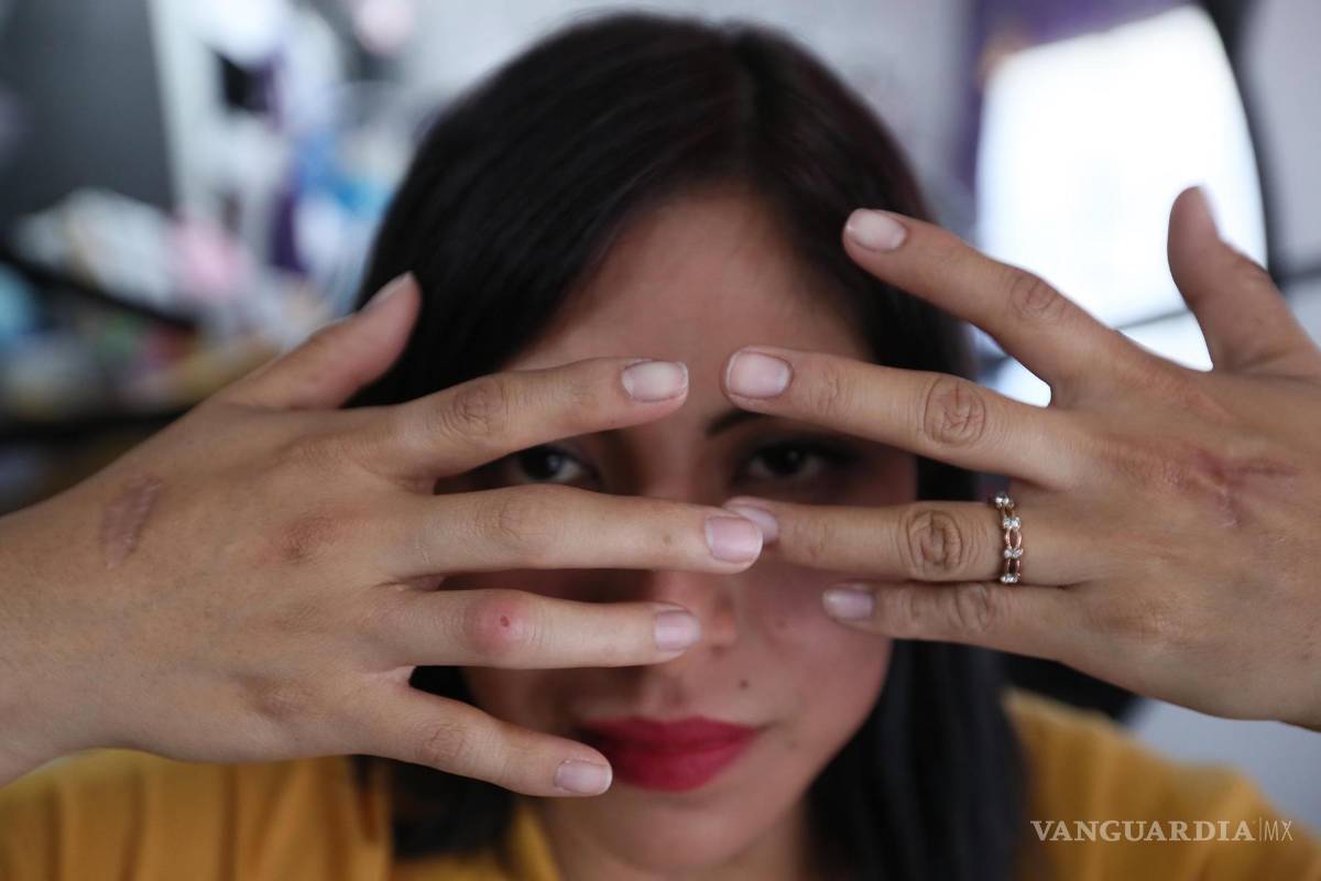 $!“Yo ya no quiero ni puedo seguir escondiéndome”, dijo Ayyselet Gutiérrez en una entrevista en Ciudad de México (México).