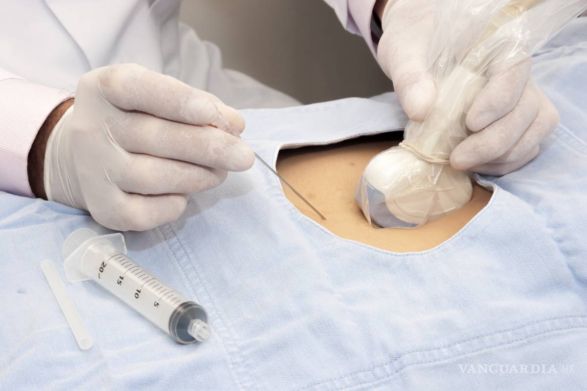 ¿Adiós a la amniocentesis?