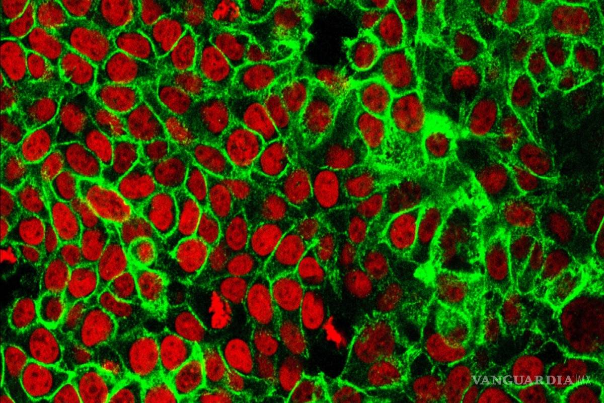Avances en medicinas contra el cáncer pulmonar, colon, próstata hacen que el tratamiento sea más fácil de tolerar