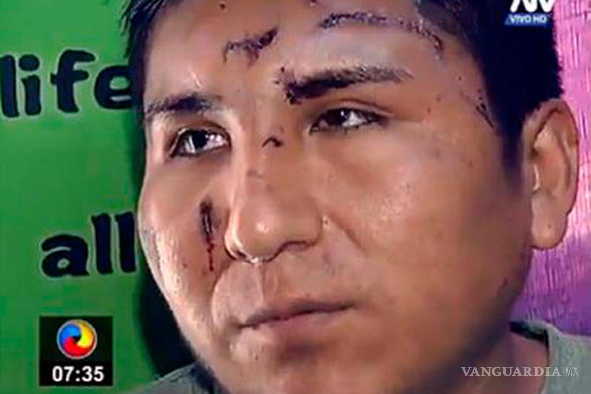 Taxista quedó golpeado por defender a joven pero evita que sea violada