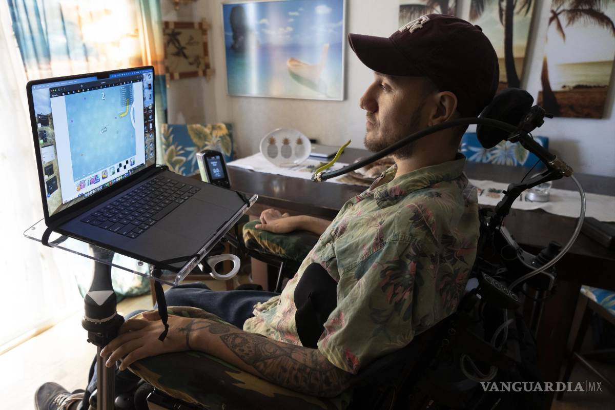 $!Hace apenas cuatro meses, a Noland Arbaugh le extirparon un círculo de hueso del cráneo y le introdujeron en el cerebro unos sensores.