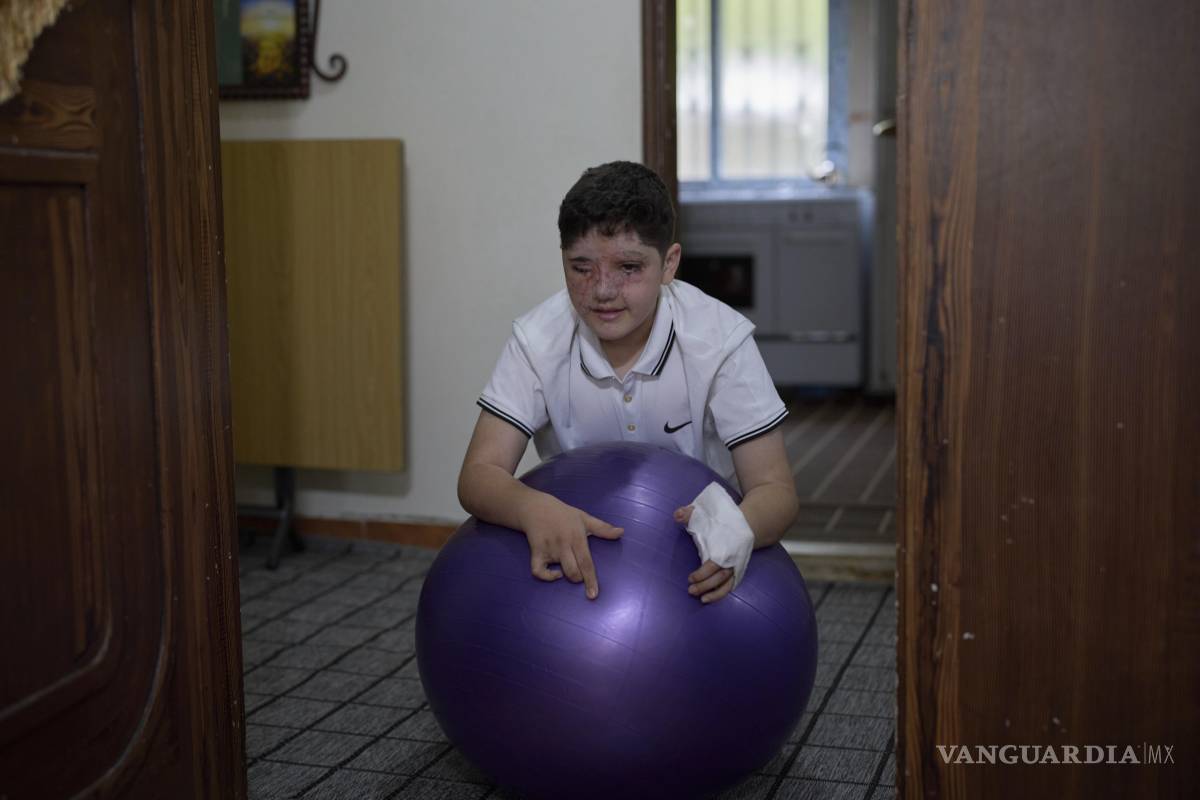 $!Ali Abbas, de 11 años, quien resultó herido en el ataque con bípers contra Hezbollah llevado a cabo por Israel el 17 de septiembre de 2024 en la casa de sus padres.