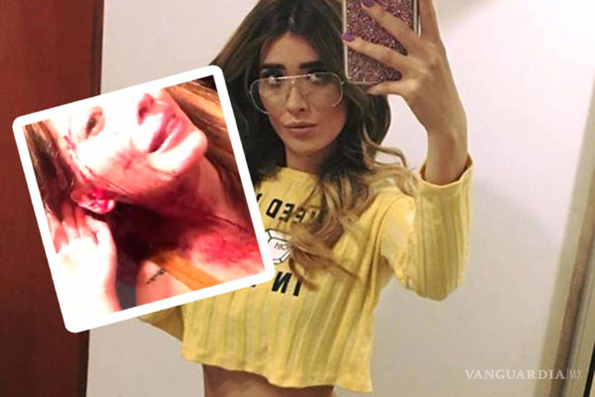 Brenda Zambrano de Aca Shore fue golpeada en un antro