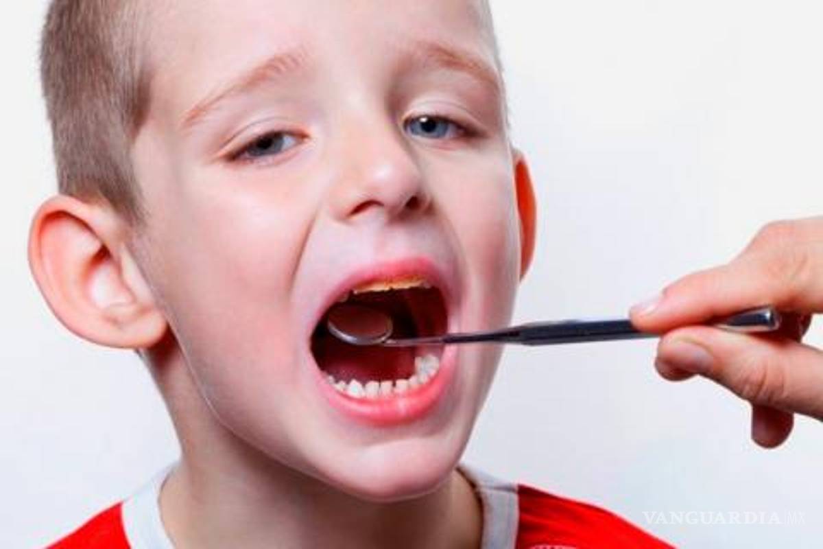 Nueve de cada 10 mexicanos tienen caries