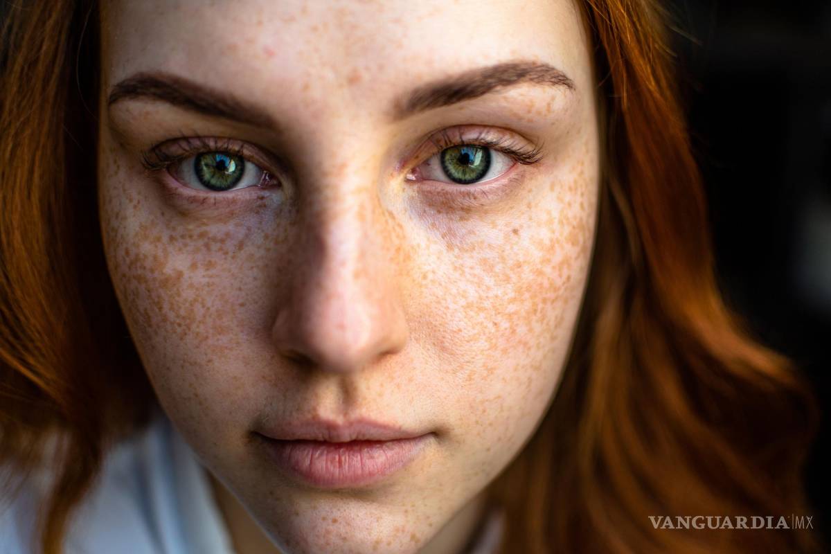 $!Las mujeres francesas que llevaban una dieta mediterránea corrían un riesgo mucho menor de desarrollar cáncer de piel que las que no lo hacían.