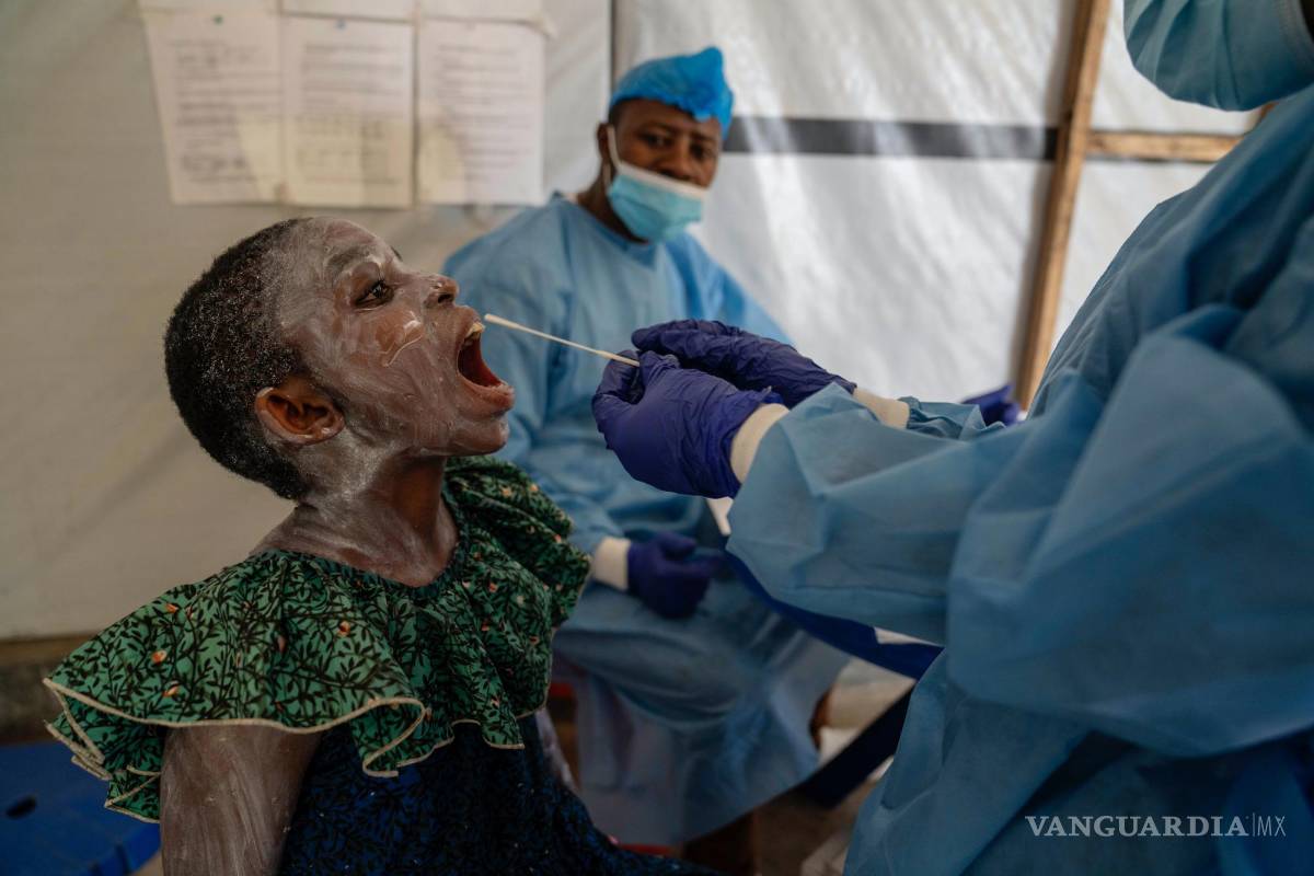 $!Un trabajador sanitario toma una muestra de saliva a Lucie Habimana, de 13 años con viruela símica, en un centro de tratamiento en Munigi.