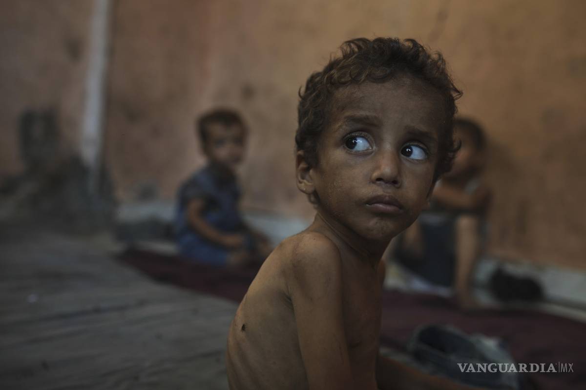 $!Yazan Abu Ful, que padece desnutrición en el campamento de refugiados Shati. El PMA señala que casi 100,000 mujeres y niños necesitan urgentemente tratamiento para la desnutrición.