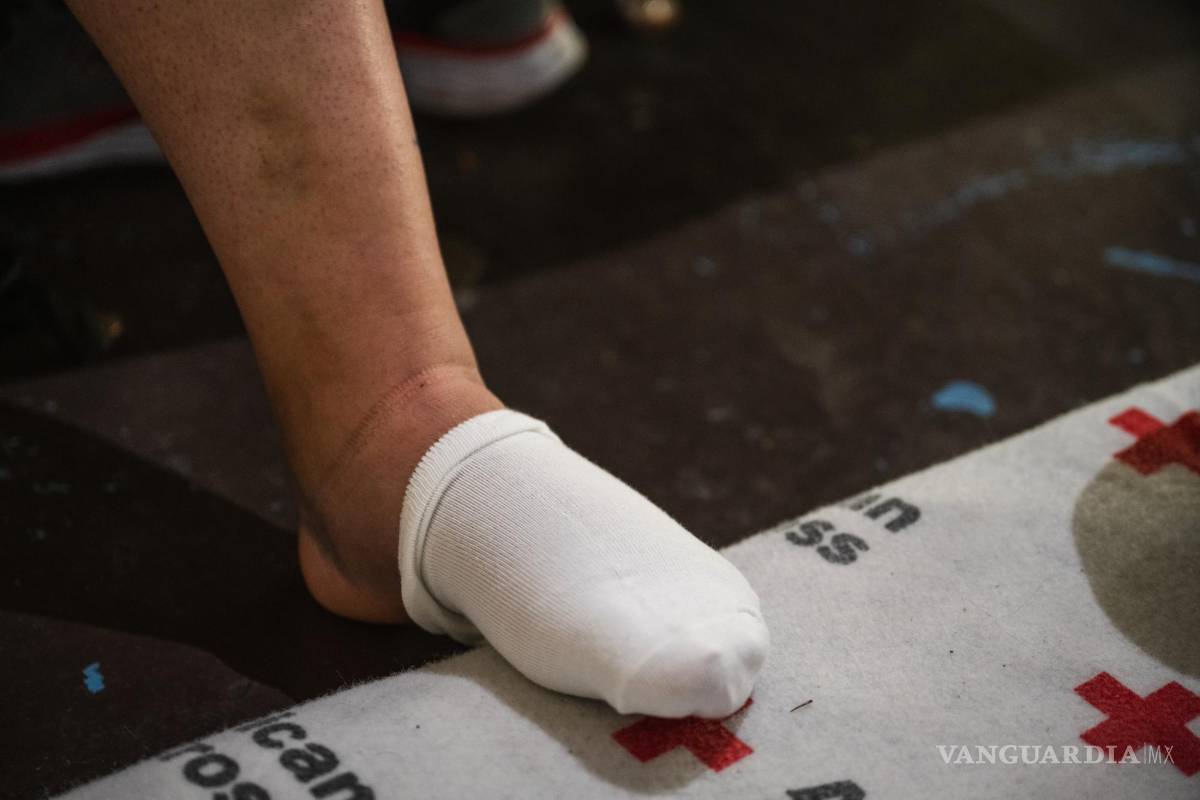 $!El pie de Rosmarie Cepeda, que se rompió al caer mientras descendía del muro fronterizo en El Paso, Texas.