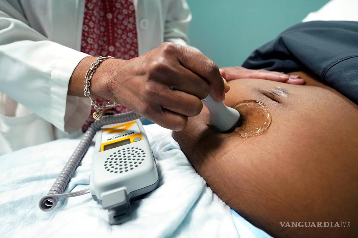 $!Un médico utiliza una sonda Doppler manual en una mujer embarazada para medir los latidos del corazón del feto en Jackson, Mississippi.