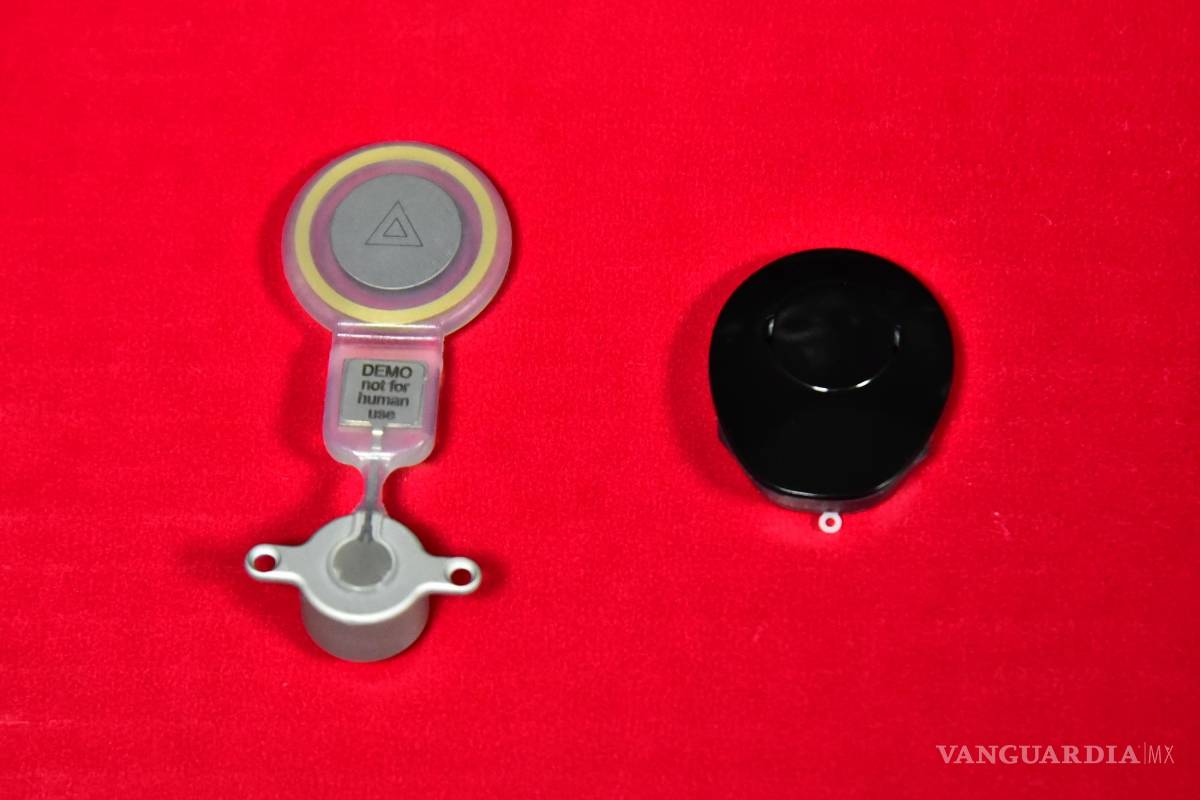 $!Guadalupe Montes, la doctora saltillense que realizó (gratis) una cirugía única en México