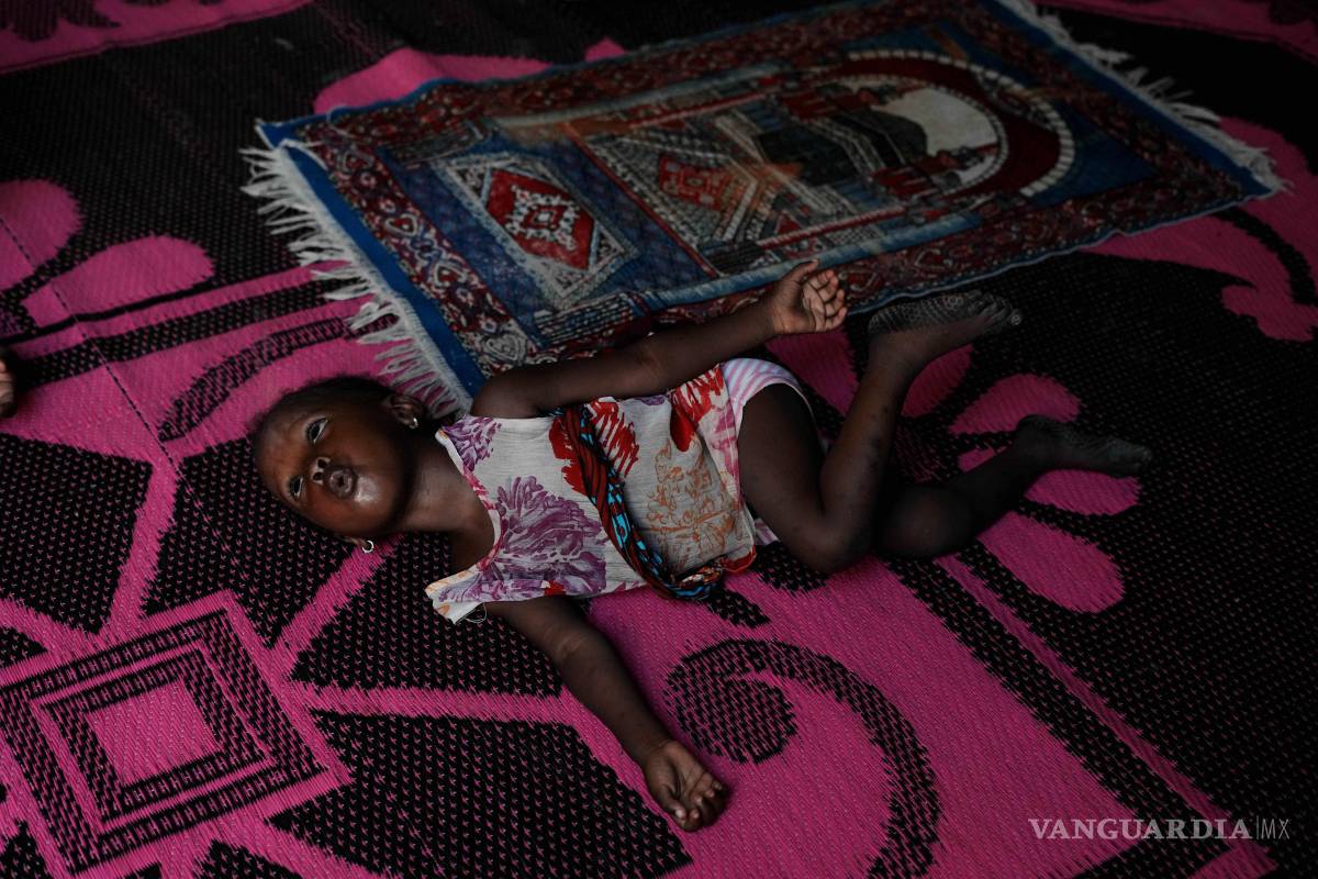 $!Farisa, que ha recaído en la malnutrición, juega en una alfombra en su casa en Kware Sokoto, en el noroeste de Nigeria, el miércoles 15 de julio de 2026.