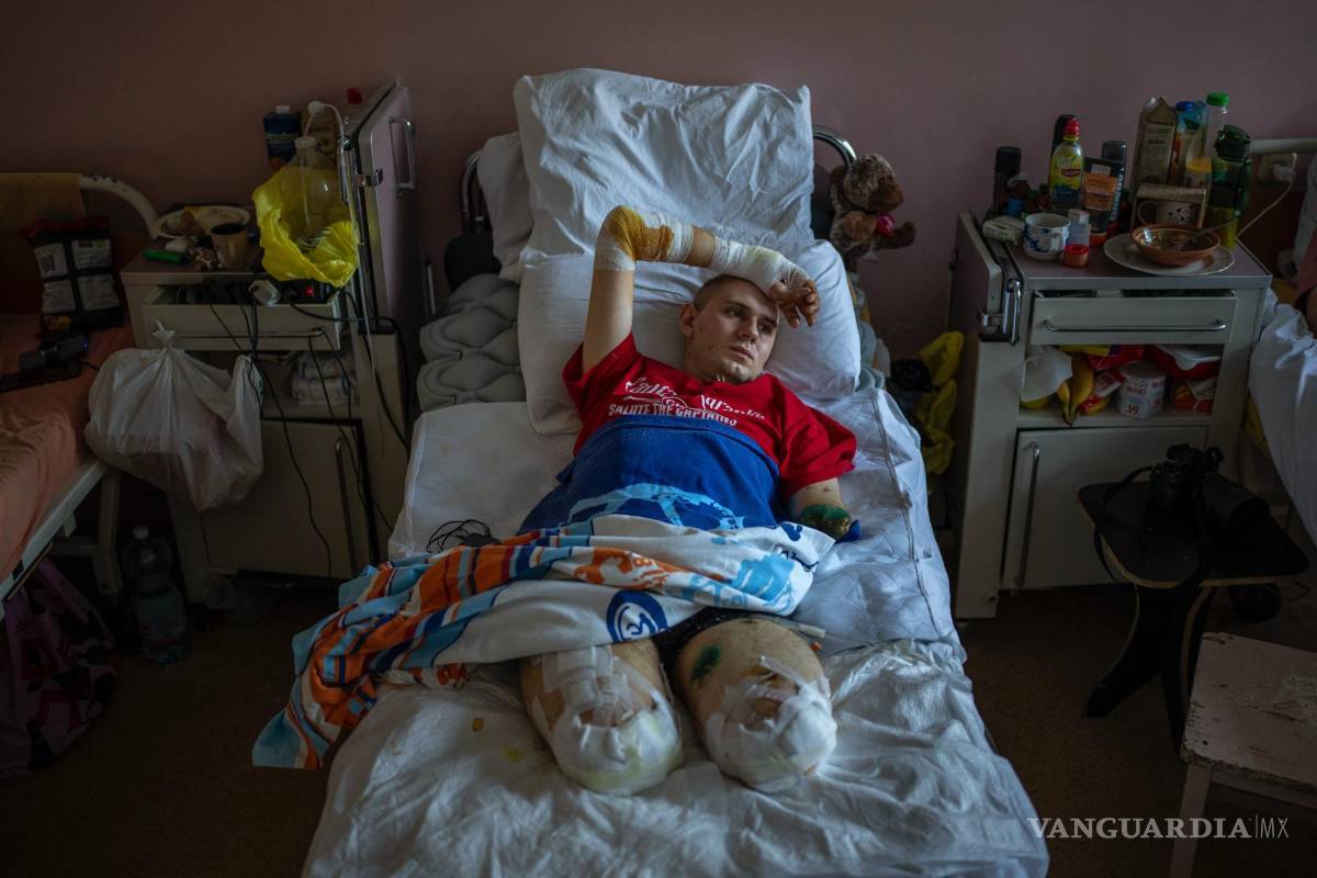 $!Anton Gladun médico militar de 22 años perdió las dos piernas y un brazo en la explosión de una mina el 27 de marzo.