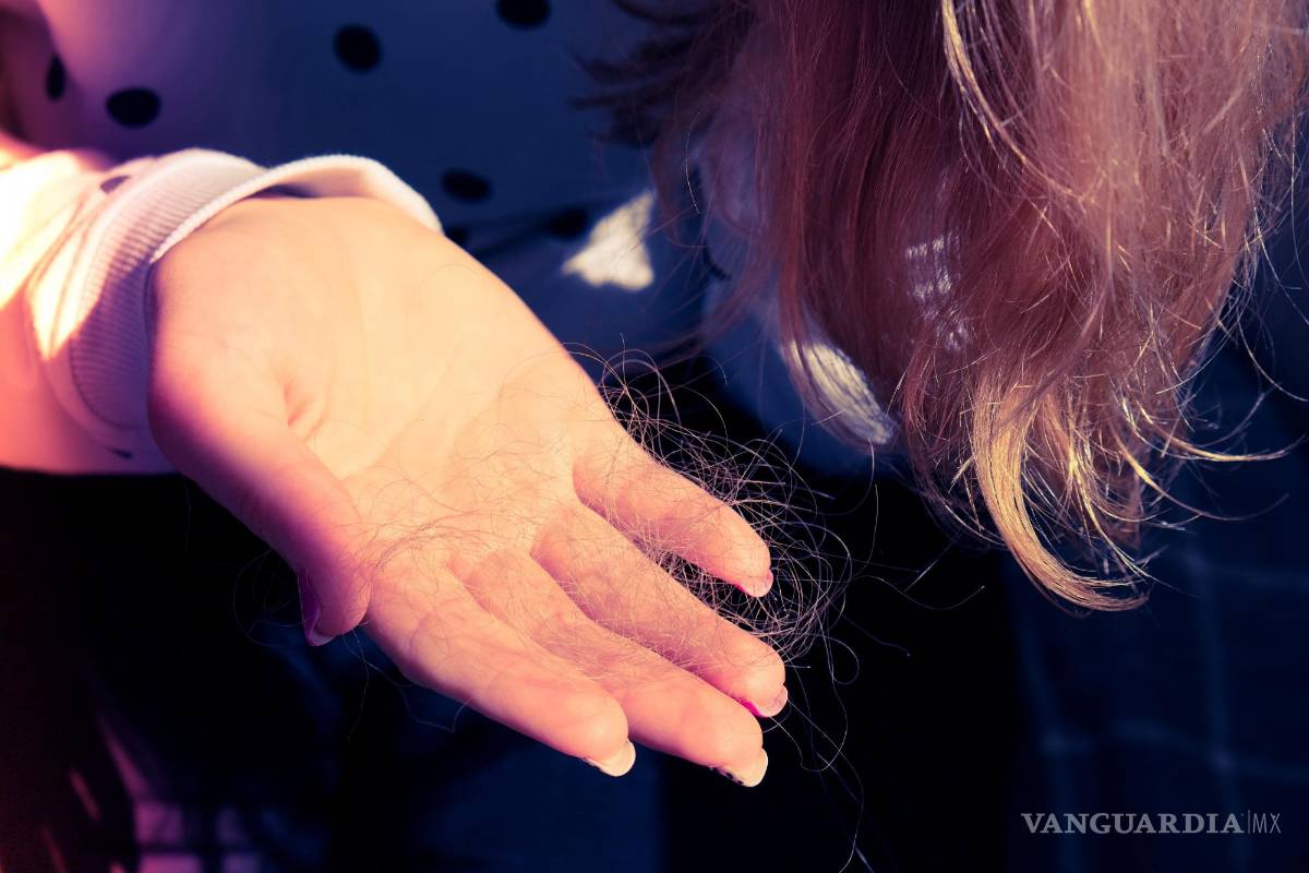 $!Uno de los síntomas frecuentes de la diabetes es la caída de cabello. EFE/Hospital Capilar