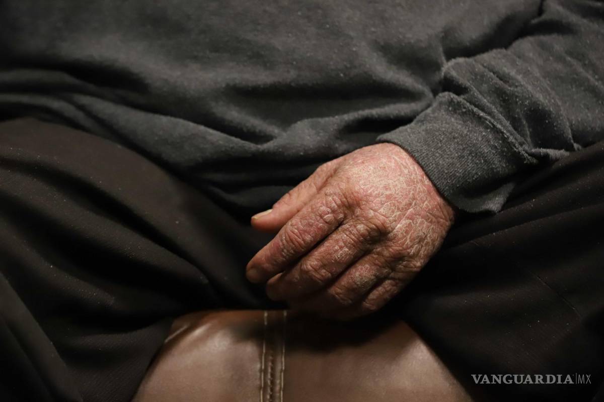 $!Regino Medina, originario de la Ciudad de México, tiene muchas ganas de salir adelante, a pesar de las limitaciones físicas impuestas por su enfermedad.