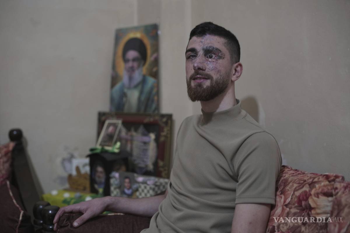 $!Mahdi Sheri, de 23 años, quien resultó herido en el ataque con bípers contra Hezbollah el 17 de septiembre de 2024 en el suburbi de Burj al-Barajneh, Líbano.