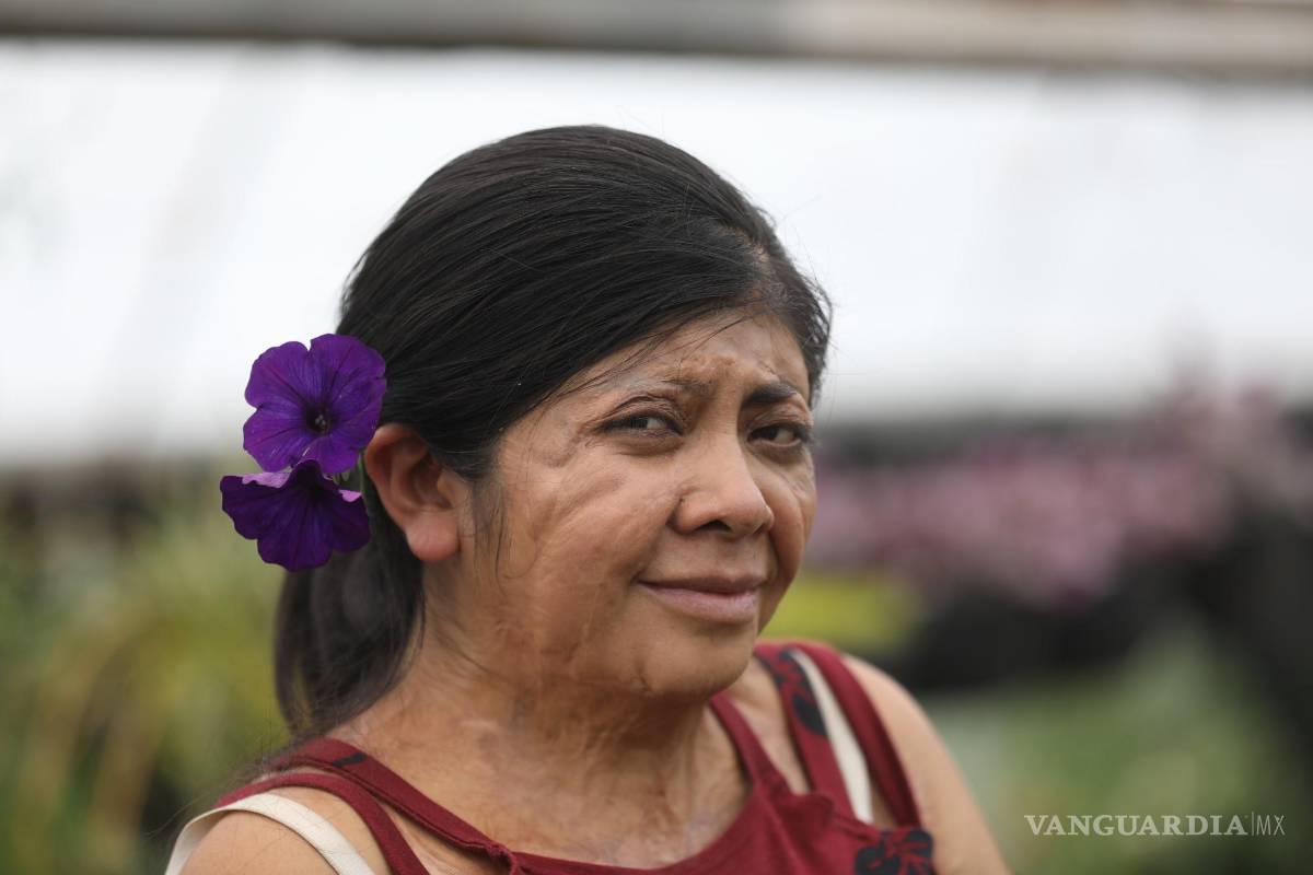 $!Elisa Xolalpa, mujer sobreviviente de ataque con ácido por su entonces pareja Ciudad de México (México).