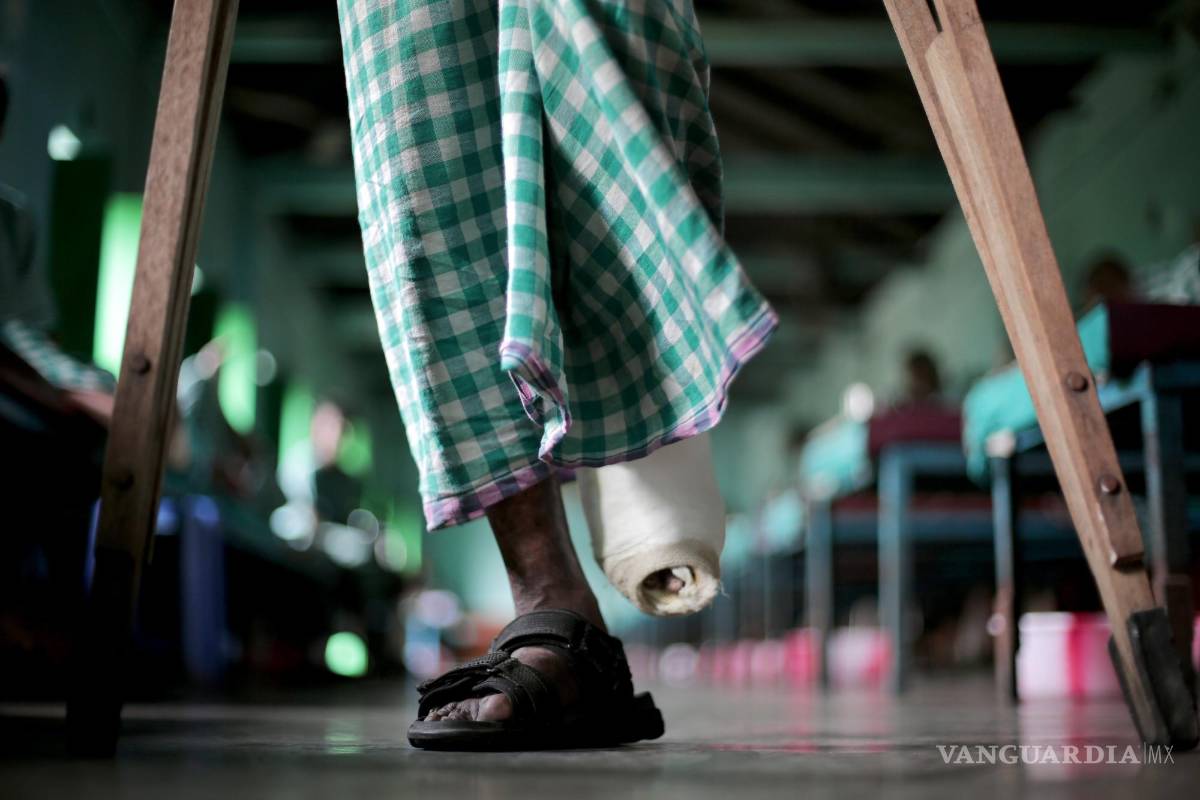 $!Imagen de un enfermo de lepra, enfermedad muy relacionada con la pobreza.