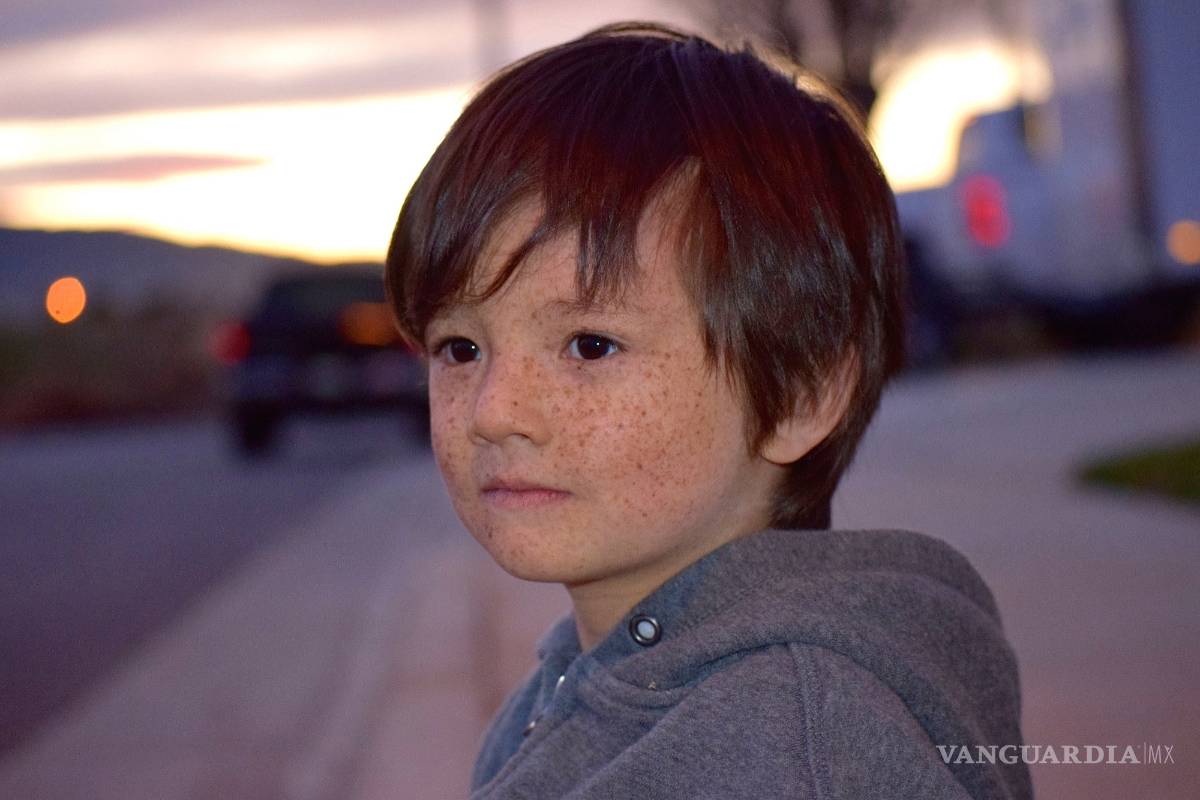 $!Oliver Kei, el 'hijo de la luna': es tan alérgico al sol que debe usar un traje especial todos los días