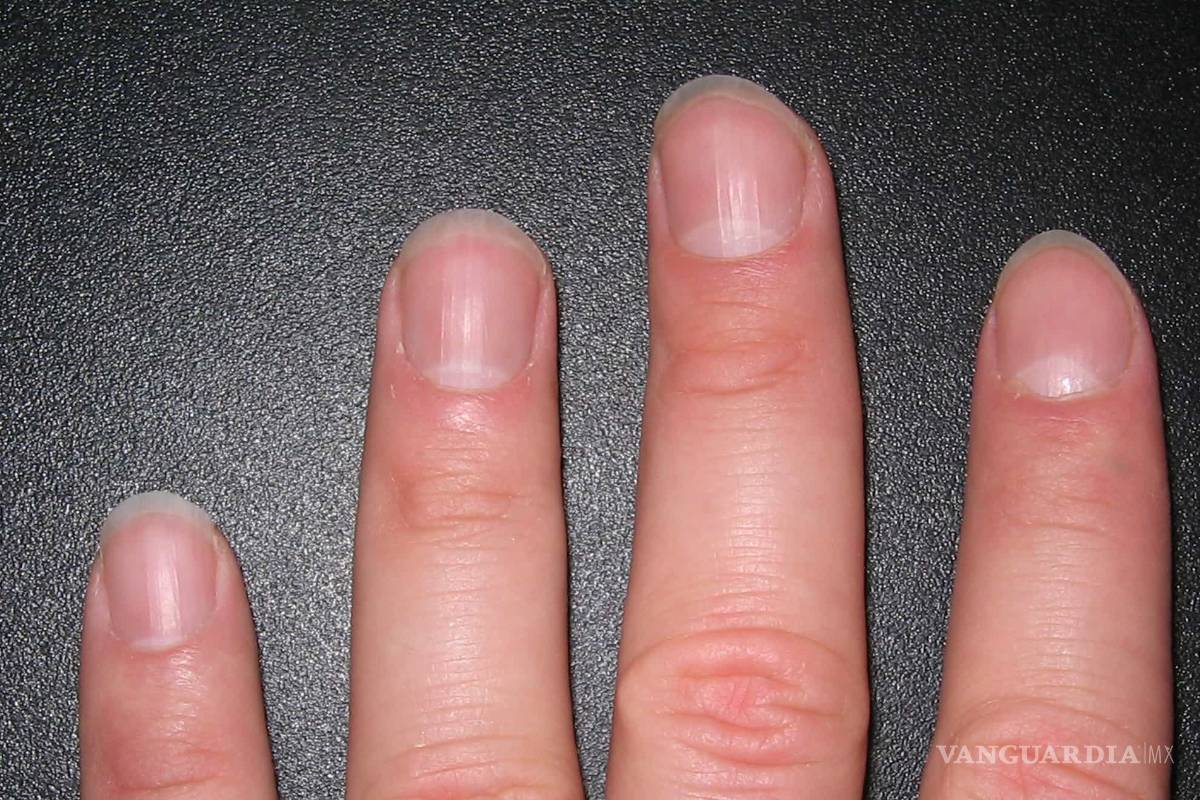 $!Los 7 problemas de uñas más frecuentes y cómo evitarlos