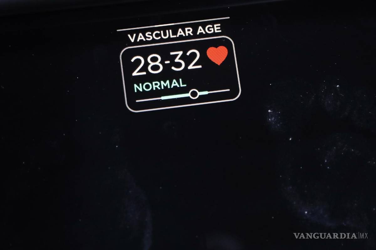 $!La báscula inteligente de Withings que incluye características como evaluación de nervios y mediciones de ECG. EFE/EPA/Caroline Brehman