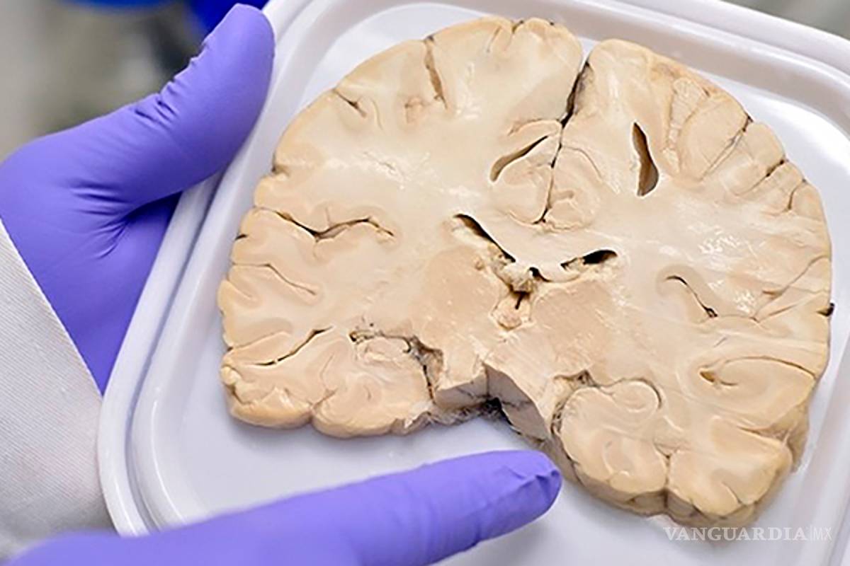 Científica mexicana da pauta a nuevos métodos de diagnóstico y tratamiento para Alzheimer