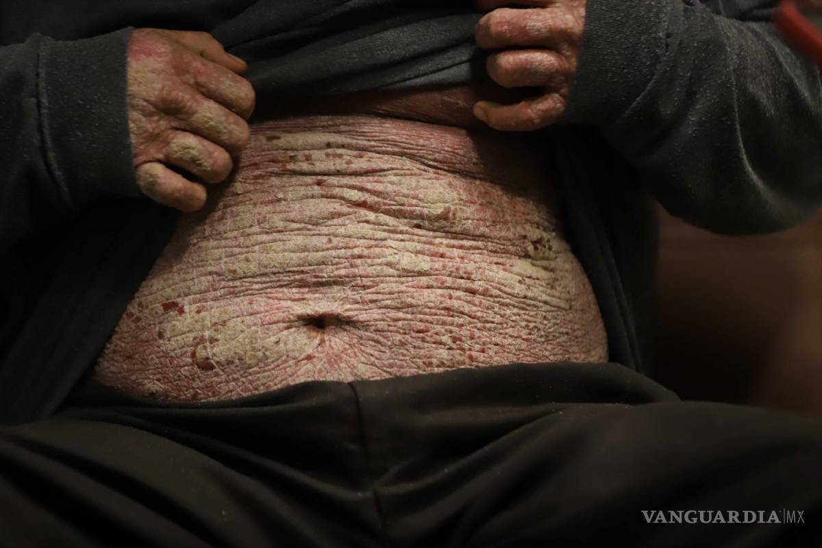 $!Medina ha recorrido el centro de Saltillo en busca de trabajo, enfrentando discriminación y humillaciones por su condición.