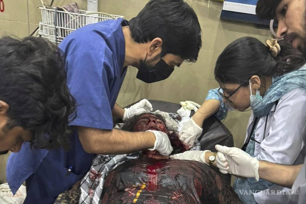 $!En esta foto distribuida por Inter Services Public Relations, una mujer herida por un presunto ataque de India con misiles recibe tratamiento en un hospital de Bahawalpur, Pakistán, el 7 de mayo de 2025.