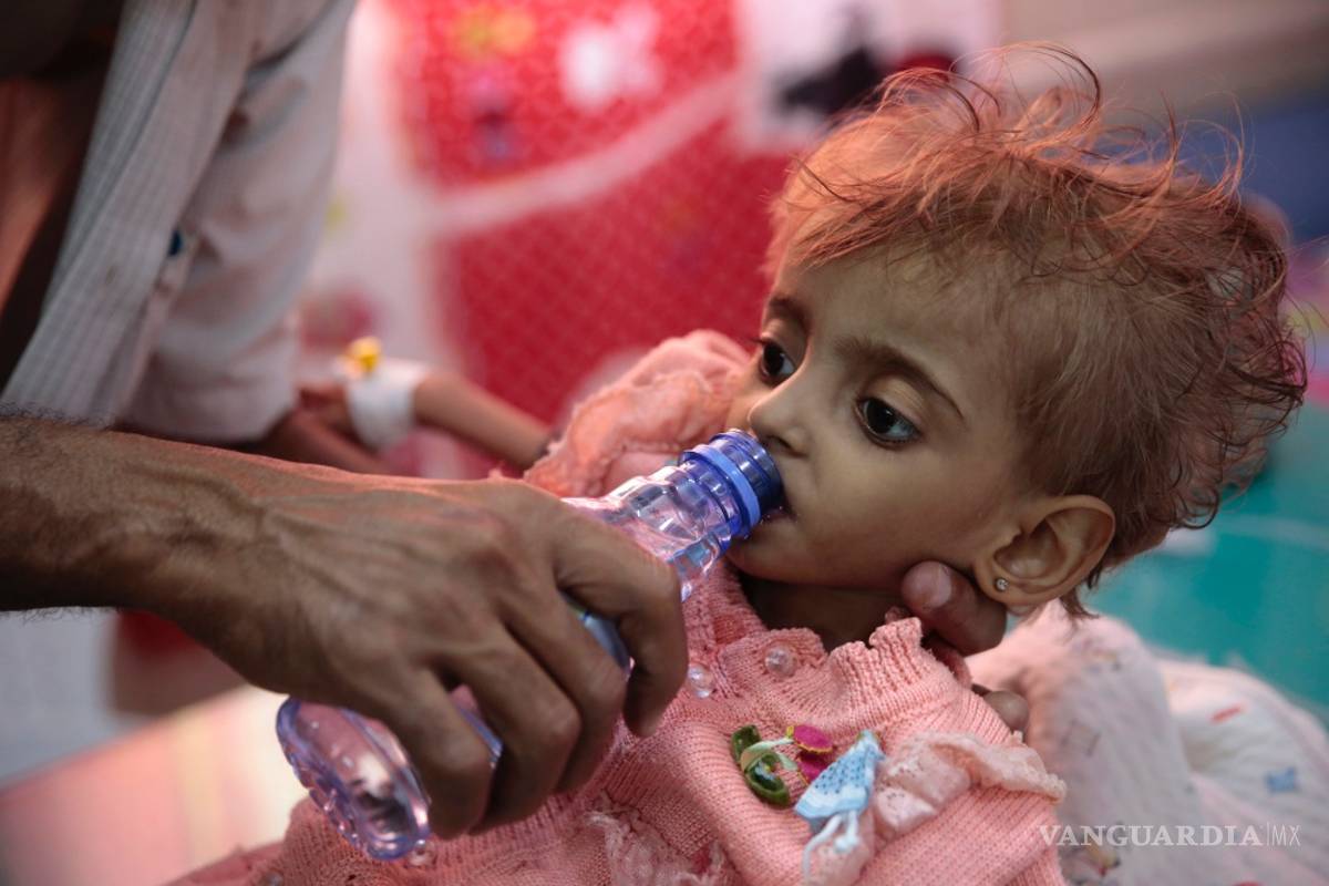 Según Save the Children, el hambre habría matado a 85 mil niños en Yemen