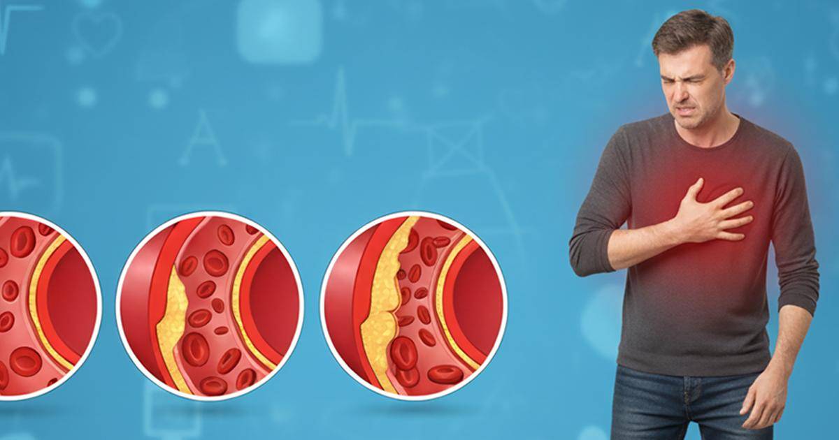Colesterol alto: Señales en tu cuerpo que lo revelan sin análisis