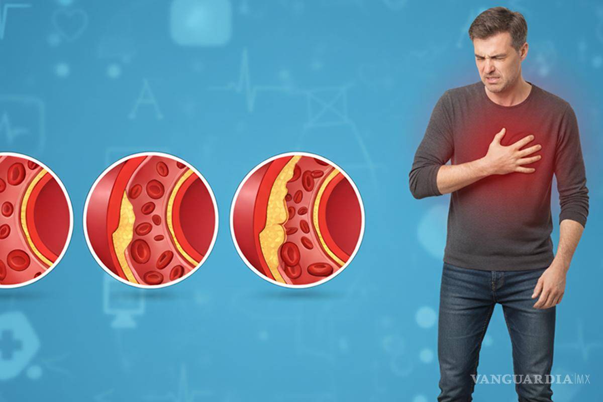 Colesterol alto: Señales en tu cuerpo que lo revelan sin análisis