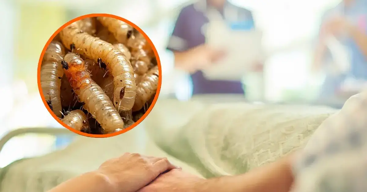 Yucatán: Confirman primera persona infectada con gusano barrenador; ya fue dado de alta