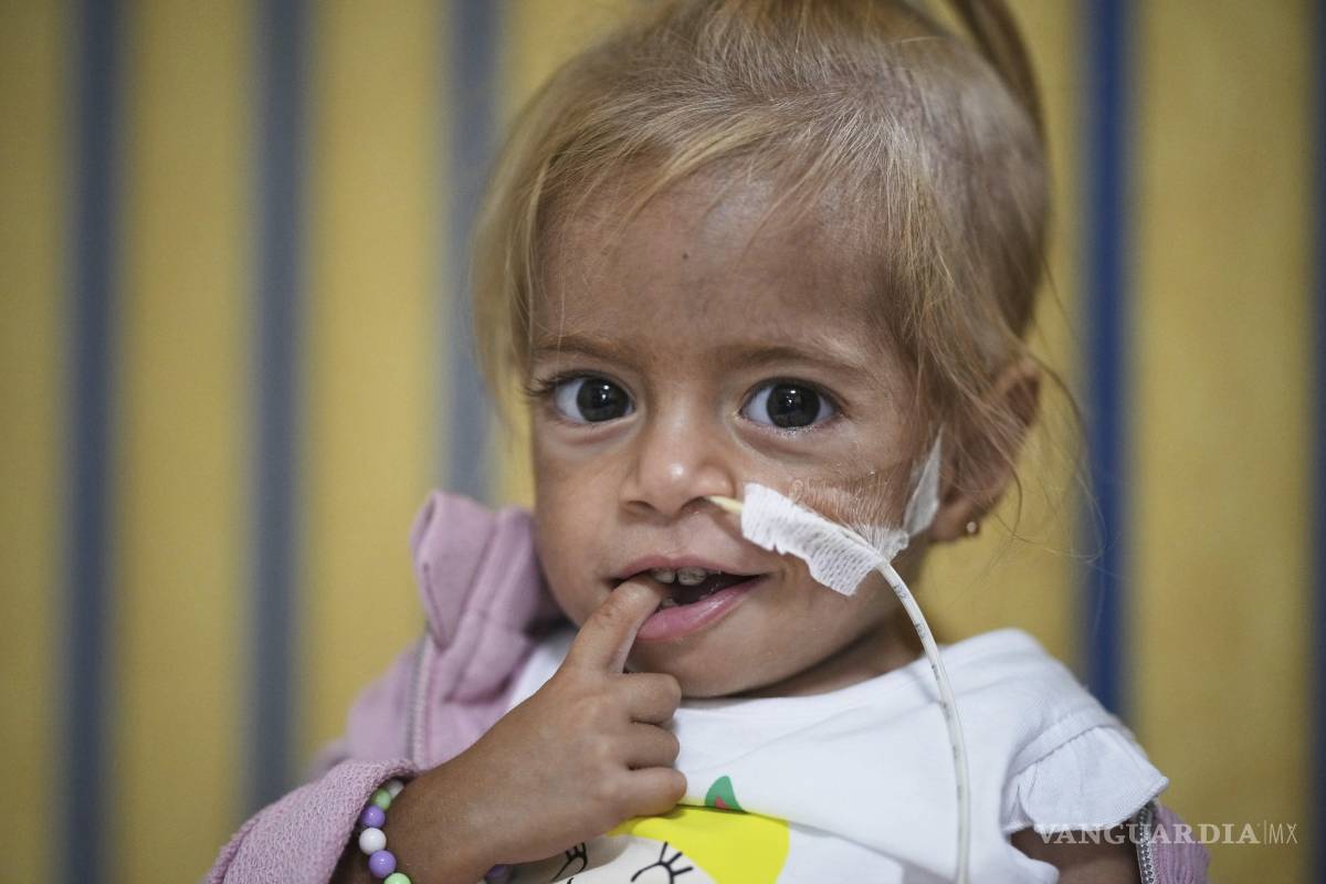 $!Shamm Qudeih sufría desnutrición desde que nació. Ahora pesa 5.5 kgs, que sigue siendo menos de la mitad del peso medio de una niña de su edad.