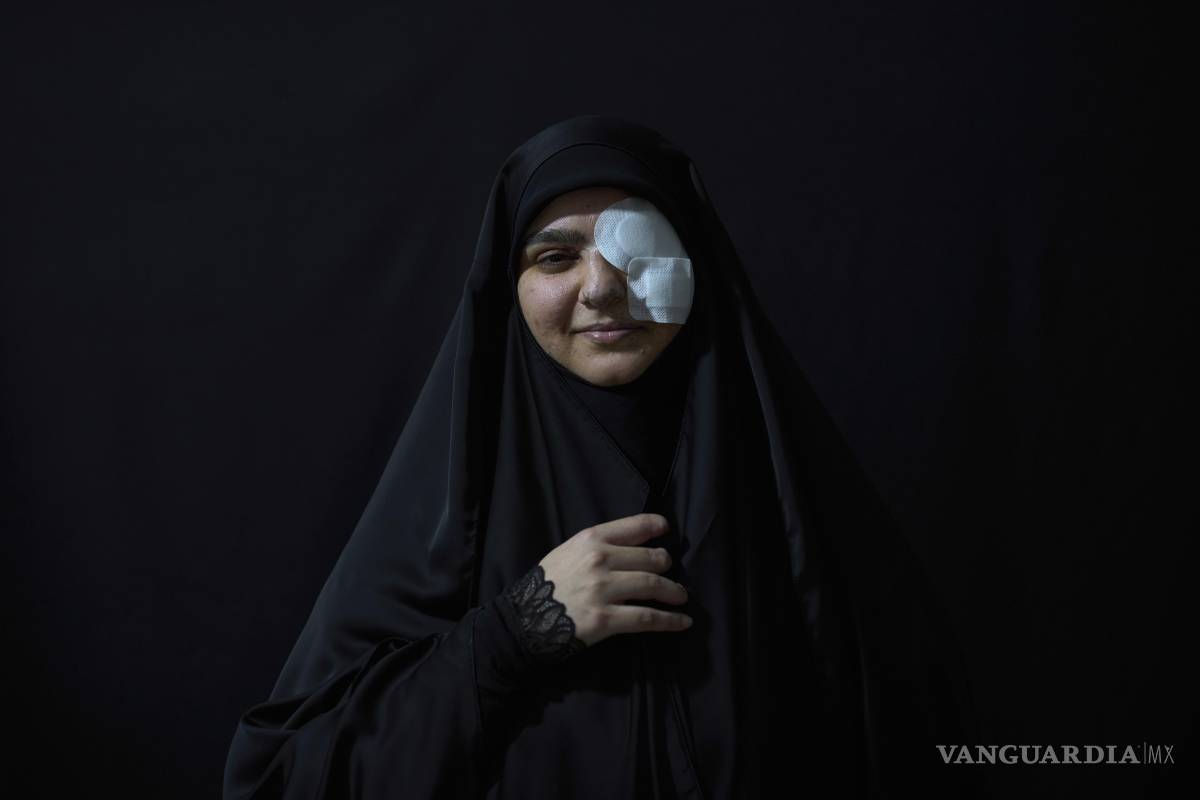 Ataques israelíes con bípers explosivos deja muchas personas heridas y con cicatrices profundas