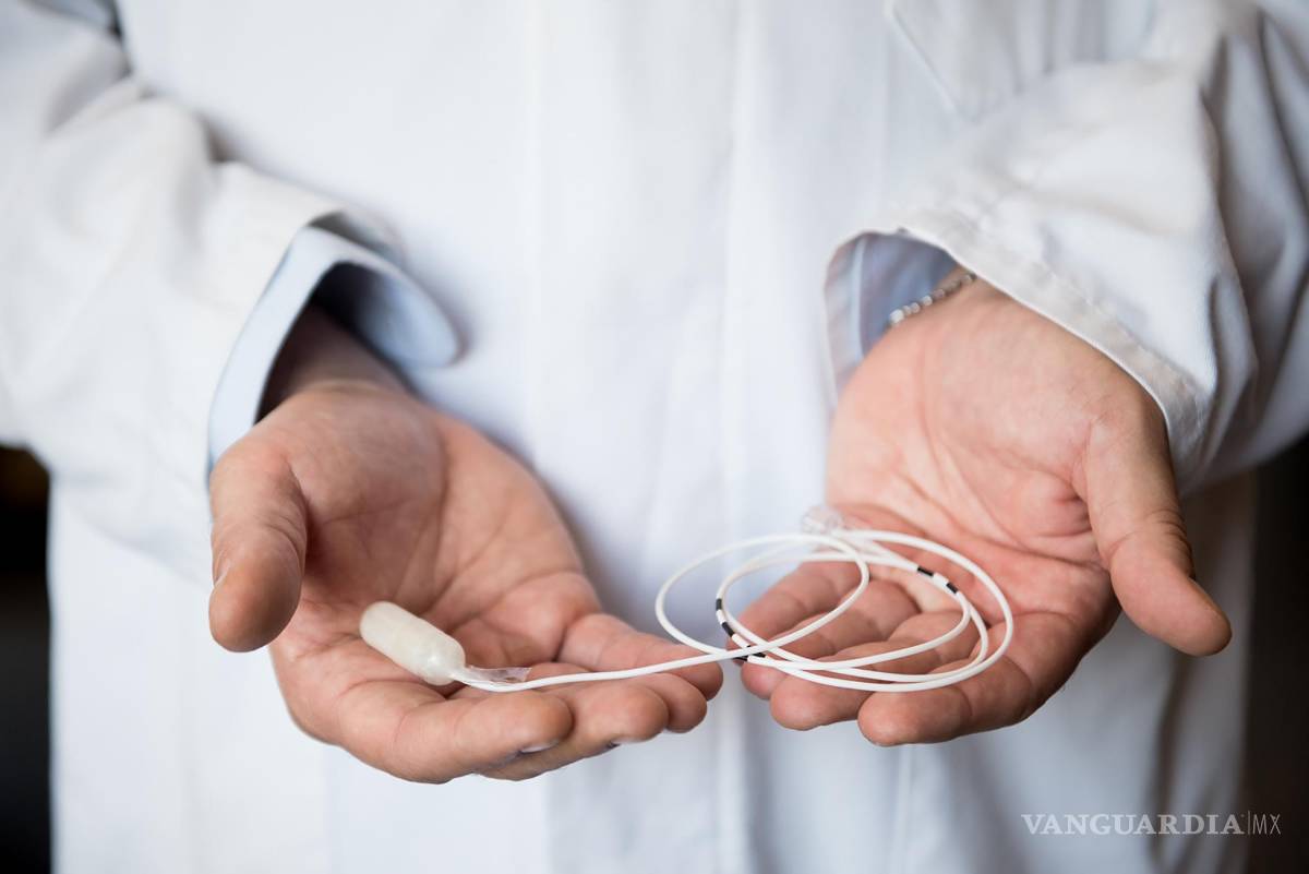 $!Cápsula con balón plegado en su interior y catéter de llenado.