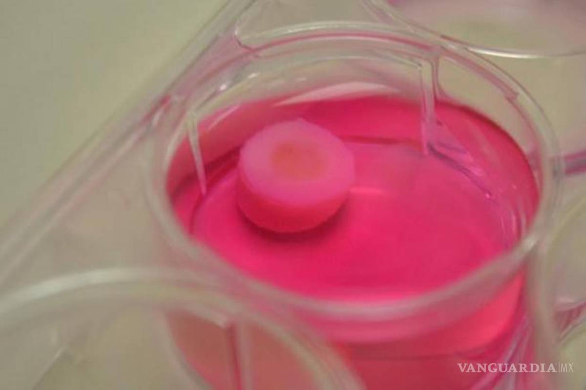 Logran imprimir cartílagos para enfermos de artritis