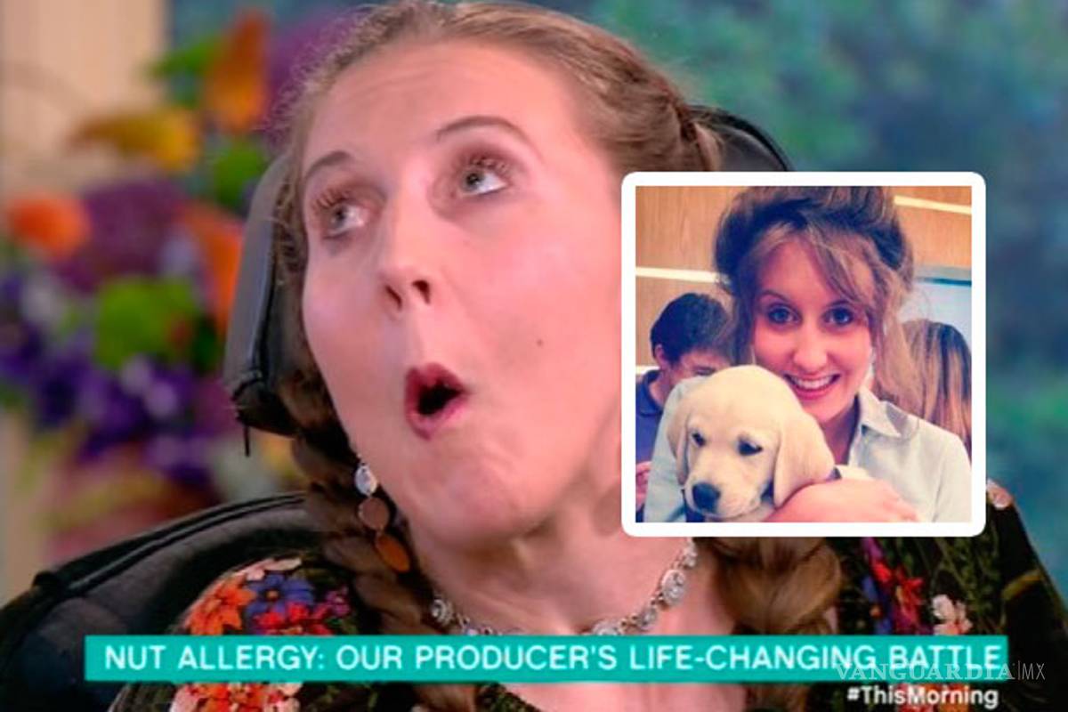 Comer nueces la dejó con daño cerebral permanente y en silla de ruedas