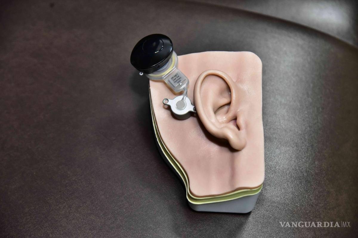 $!Demo de implante auditivo.