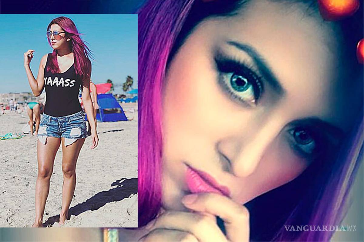 Así luce hoy la niña del "Piquito de pollo", a sus 29 años (fotos)