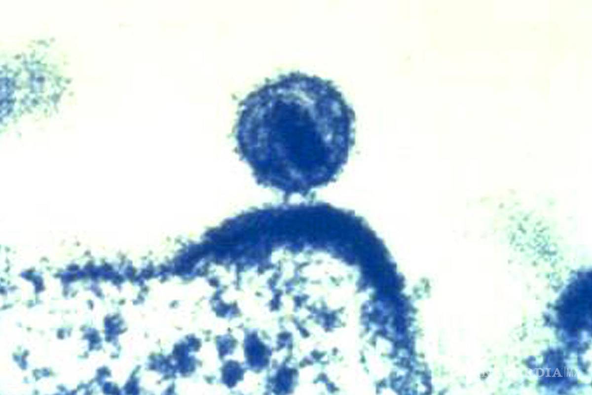 Hallan en Holanda variante más virulenta del VIH