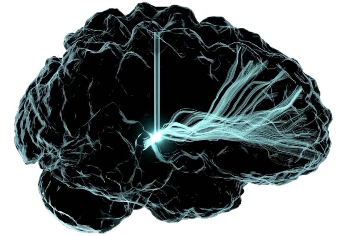 $!Como resultado de un total de 21 estudios de investigación, mismos que conforman el atlas celular del cerebro.