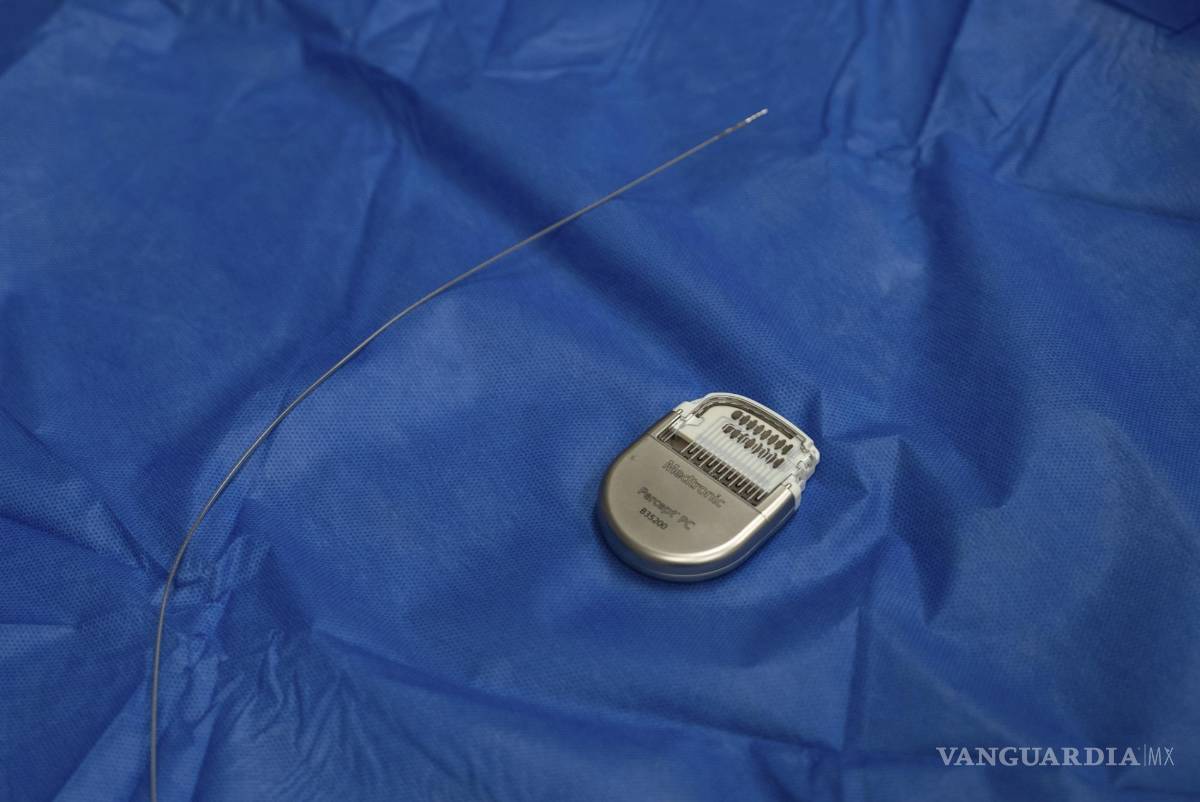 $!Una muestra de un dispositivo similar a un marcapasos, utilizado para la terapia de estimulación cerebral profunda.