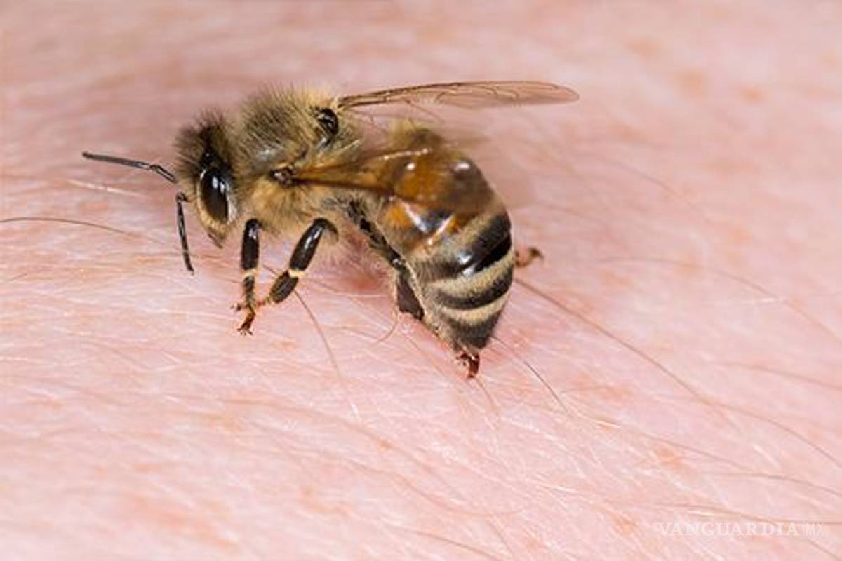 Abejas se defienden; niños de Torreón reciben picaduras tras atacar panal