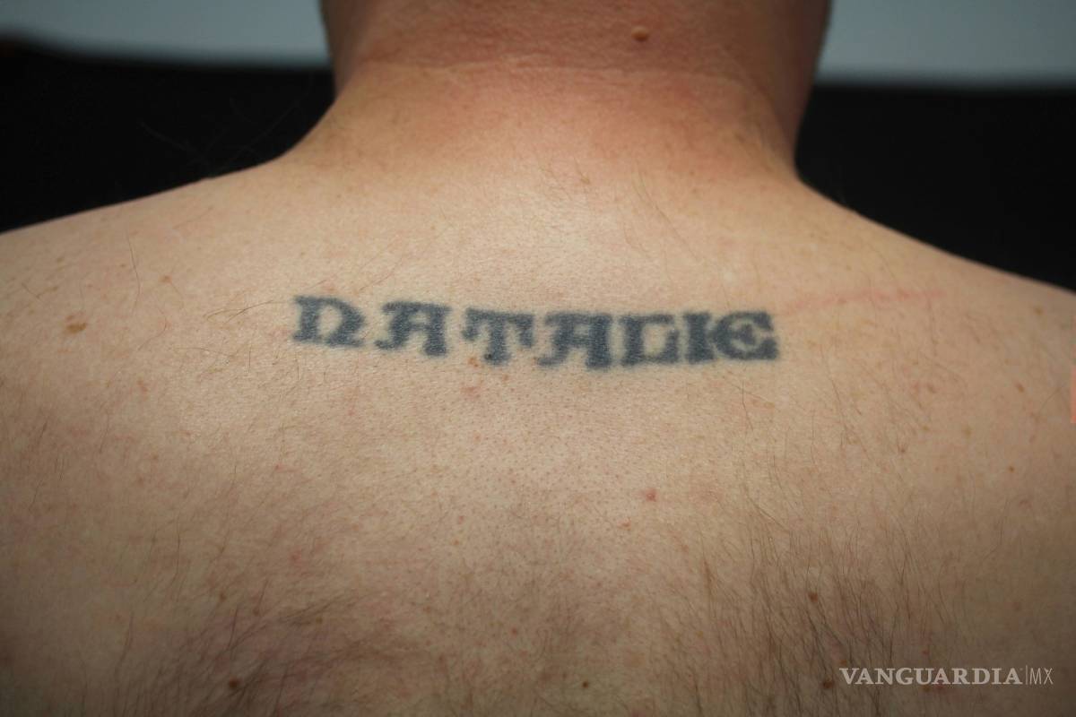 ¿Te arrepientes de tu tatuaje?, sigue estos consejos para eliminarlo