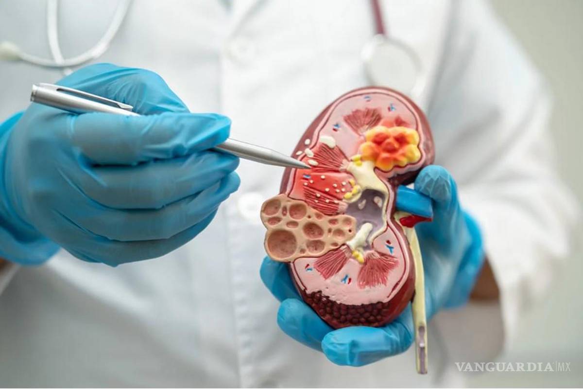 Coahuila: ¡Cuídese! La diabetes es la principal causa del daño renal