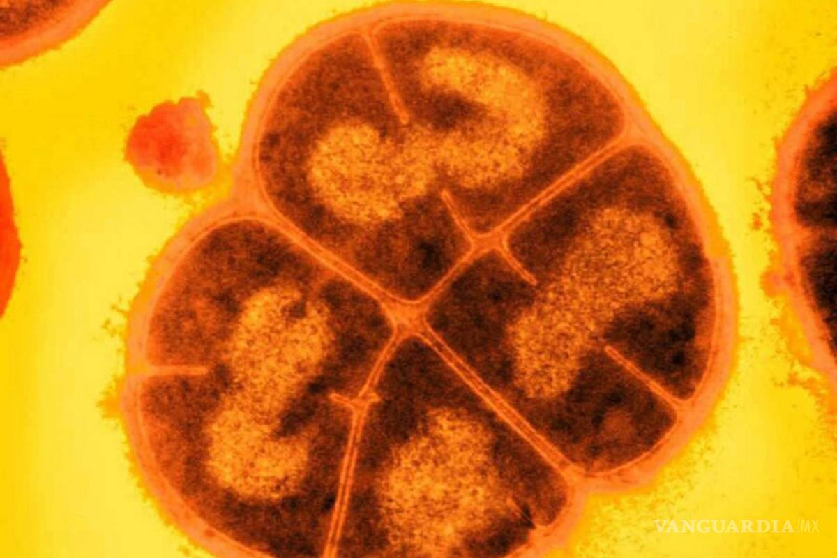 Conan, una sorprendente bacteria capaz de soporta la radiación extrema